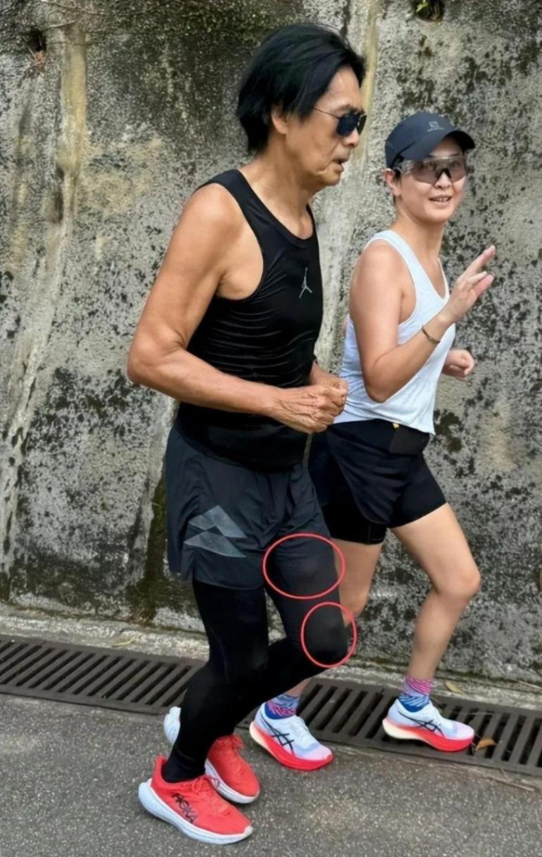辟谣 周润发否认患肿瘤 称是皮下脂肪
