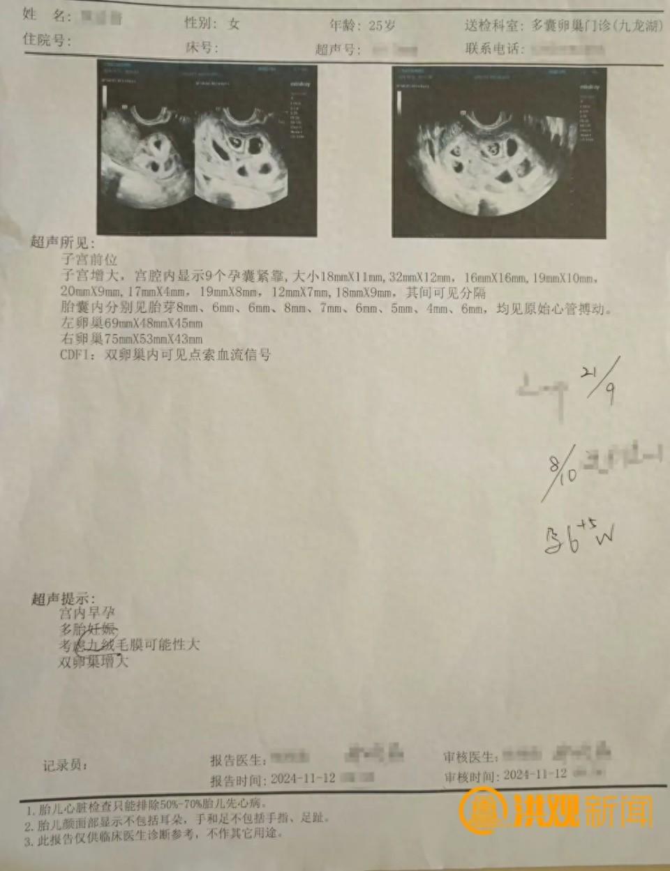 怀9胞胎女子丈夫决定减胎