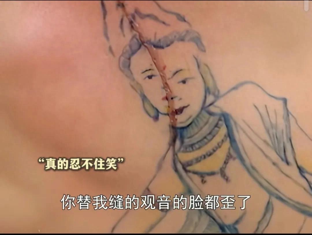 医生给刺青患者“缝龙”直呼太难了