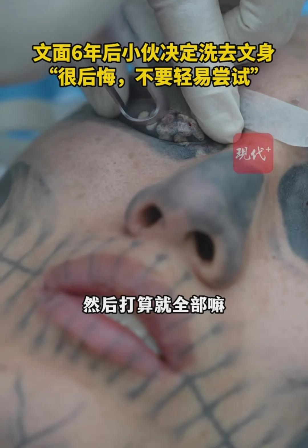 男子处处碰壁决定清洗满脸文身